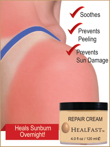 How To Heal Sunburn Fast Without Peeling