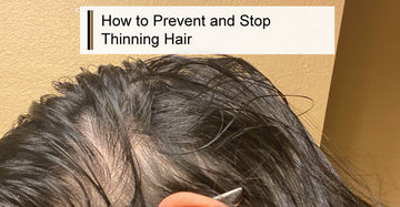 How To Prevent and Stop Thinning Hair