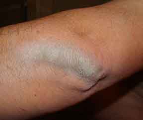 How To Get Rid of Ashy Skin For Good
