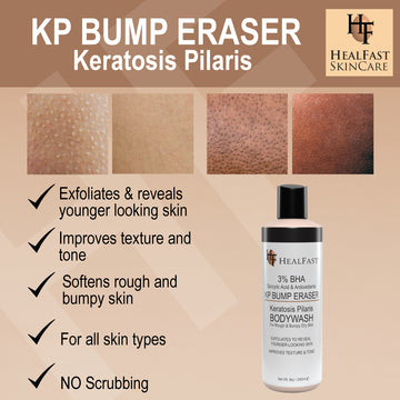 KP BUMP ERASER SET