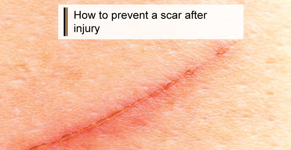 How to Prevent a Scar After an Injury