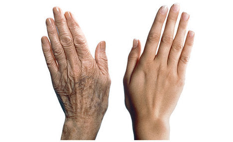 Are Your Hands Showing Your Age?