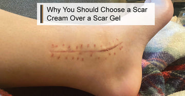 Why You Should Choose a Scar Cream Over a Scar Gel