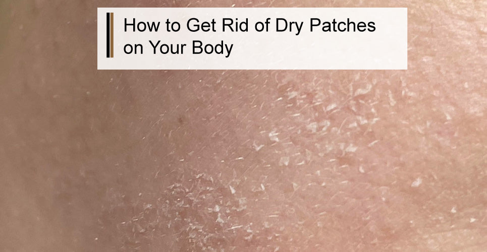 How to Get Rid of Dry Patches on Your Body