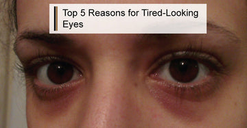 Top 5 Reasons For Tired Looking Eyes