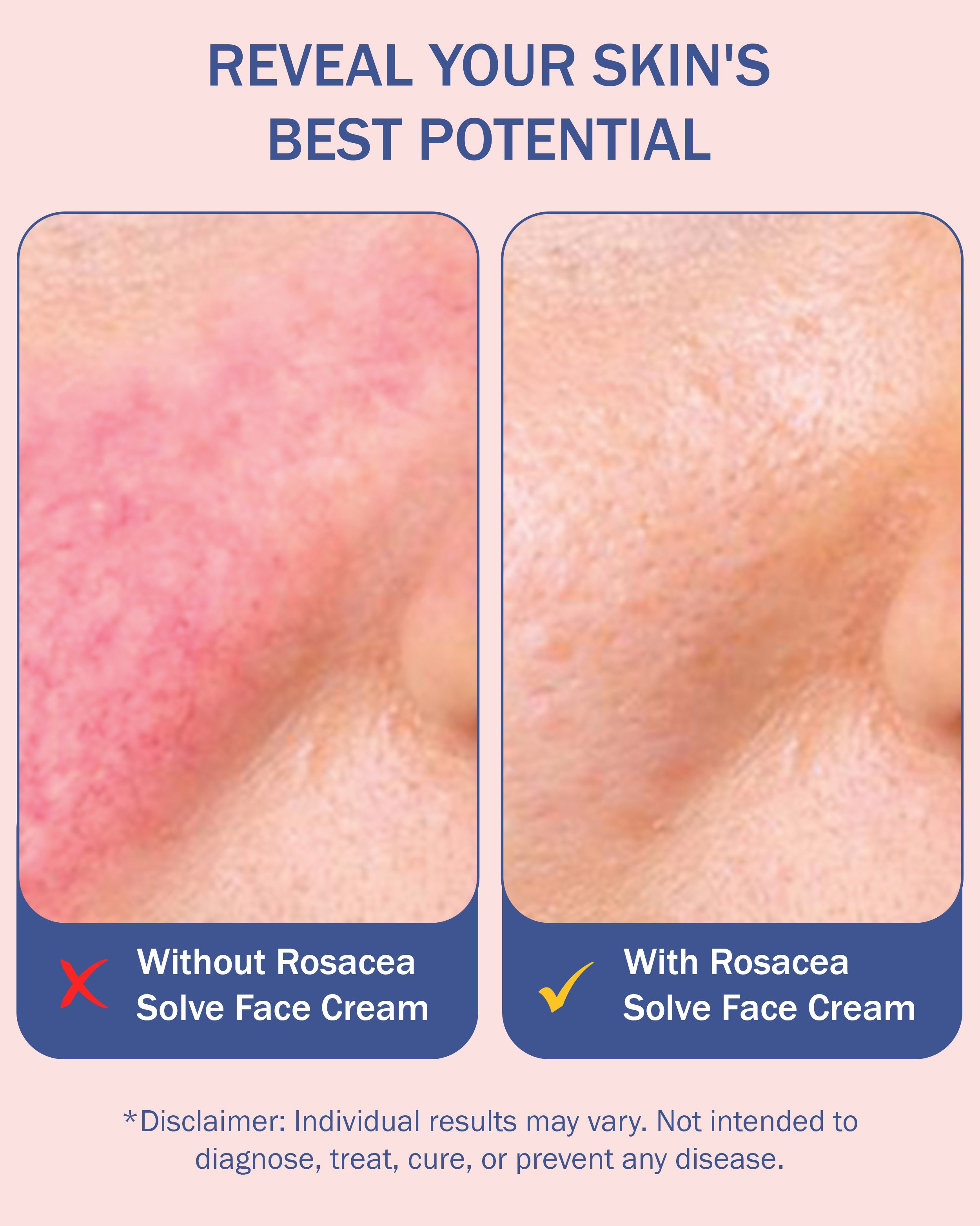 e70 Rosacea Solve Serum