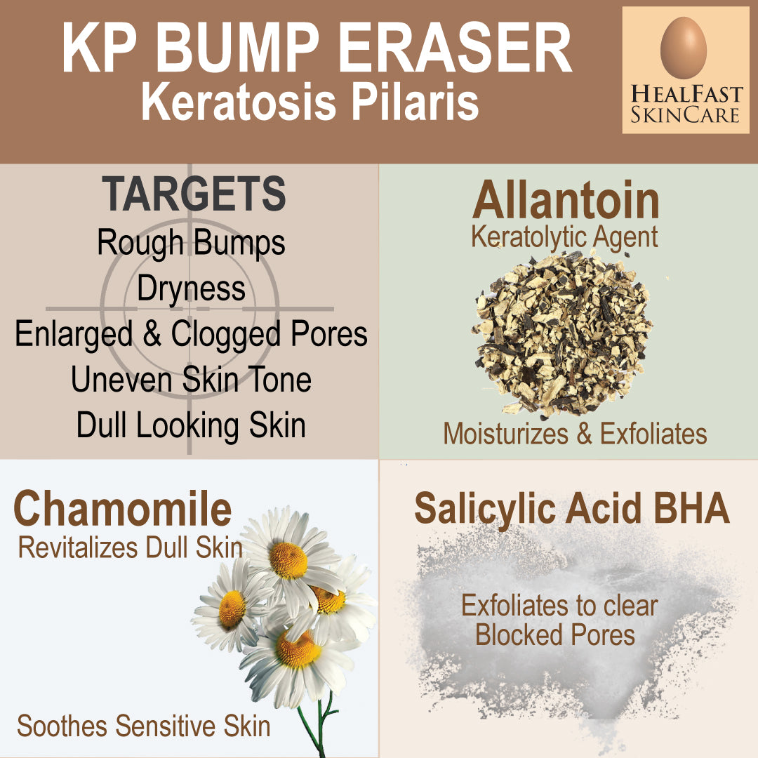 KP Bump Eraser Cream