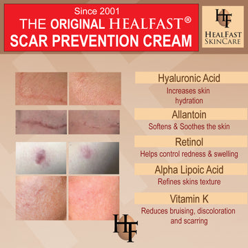 HealFast Scar Prevention Cream
